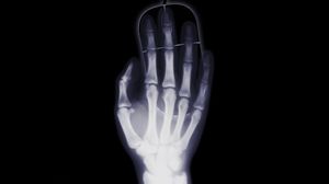 Preview wallpaper arm, x-ray, bone, computer mouse